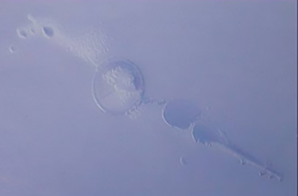 360-1-困气：注塑时带入空气